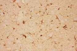 Invitrogen CNTF Polyclonal Antibody 100 &mu;g | Buy Online | Invitrogen&trade; | Fisher Scientific