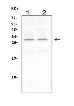 Invitrogen CNTF Polyclonal Antibody 100 &mu;g | Buy Online | Invitrogen&trade; | Fisher Scientific