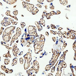 Invitrogen COL4A2 Polyclonal Antibody 100 &mu;g; Unconjugated:Antibodies,