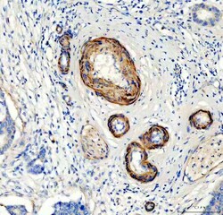 Invitrogen COL4A2 Polyclonal Antibody 100 &mu;g; Unconjugated:Antibodies,