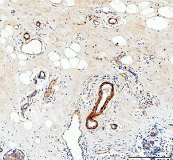 Invitrogen COL4A2 Polyclonal Antibody 100 &mu;g; Unconjugated:Antibodies,