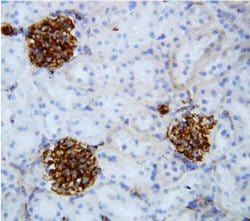 Invitrogen COL4A2 Polyclonal Antibody 100 &mu;g; Unconjugated:Antibodies,