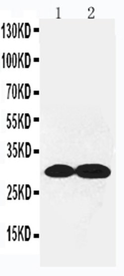 Invitrogen COL4A2 Polyclonal Antibody 100 &mu;g; Unconjugated:Antibodies,