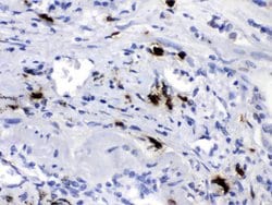 Invitrogen Carboxypeptidase B2 Polyclonal Antibody 100 &mu;g; Unconjugated:Antibodies,