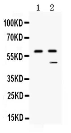 Invitrogen Carboxypeptidase B2 Polyclonal Antibody 100 &mu;g; Unconjugated:Antibodies,