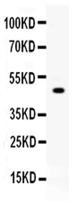 Invitrogen Carboxypeptidase B2 Polyclonal Antibody 100 &mu;g; Unconjugated:Antibodies,