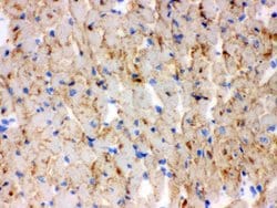CPT1B Polyclonal Antibody:Antibodies, Polyclonal