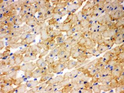 CPT1B Polyclonal Antibody:Antibodies, Polyclonal