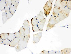 CPT1B Polyclonal Antibody:Antibodies, Polyclonal