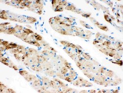 CPT1B Polyclonal Antibody:Antibodies, Polyclonal