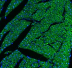 CPT1B Polyclonal Antibody:Antibodies, Polyclonal