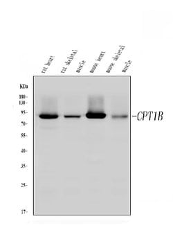 CPT1B Polyclonal Antibody:Antibodies, Polyclonal