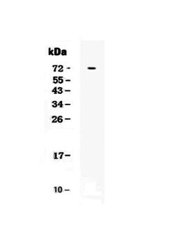 Invitrogen TSLP Receptor Polyclonal Antibody 100 &mu;g; Unconjugated:Antibodies,