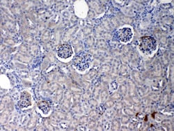 Invitrogen CRP Polyclonal Antibody 100 &mu;g; Unconjugated:Antibodies,