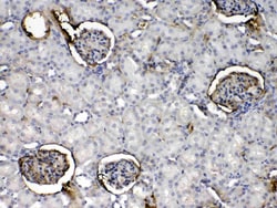 Invitrogen CRP Polyclonal Antibody 100 &mu;g; Unconjugated:Antibodies,