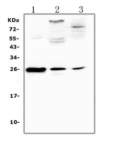 Invitrogen CRP Polyclonal Antibody 100 &mu;g; Unconjugated:Antibodies,