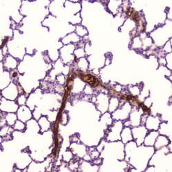 Invitrogen CRP Polyclonal Antibody 100 &mu;g; Unconjugated:Antibodies,