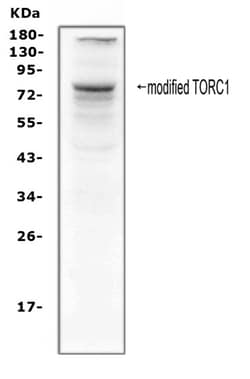 Invitrogen Torc1 Polyclonal Antibody 100 &mu;g | Buy Online | Invitrogen&trade; | Fisher Scientific