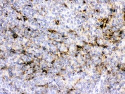 Alpha A Crystallin Polyclonal Antibody:Antibodies, Polyclonal