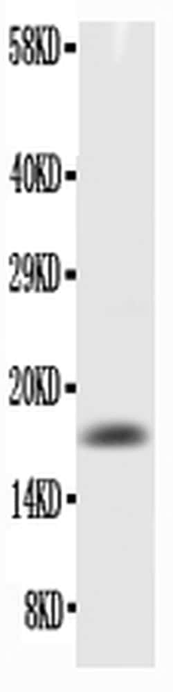 Invitrogen GM-CSF Polyclonal Antibody 100 &mu;g | Buy Online | Invitrogen&trade; | Fisher Scientific