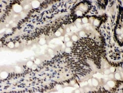 Invitrogen CK1 alpha Polyclonal Antibody 100 &mu;g; Unconjugated:Antibodies,