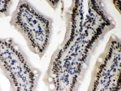 Invitrogen CK1 alpha Polyclonal Antibody 100 &mu;g; Unconjugated:Antibodies,