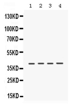 Invitrogen CK1 alpha Polyclonal Antibody 100 &mu;g; Unconjugated:Antibodies,