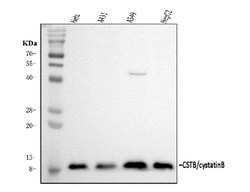 Invitrogen Cystatin B Polyclonal Antibody 100 &mu;g; Unconjugated:Antibodies,