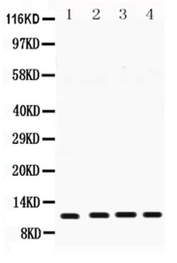 Invitrogen Cystatin B Polyclonal Antibody 100 &mu;g; Unconjugated:Antibodies,