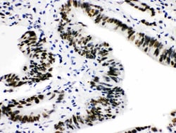 Invitrogen CtBP2 Polyclonal Antibody 100 &mu;g; Unconjugated:Antibodies,