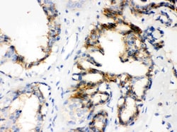 Invitrogen CTGF Polyclonal Antibody 100 &mu;g; Unconjugated:Antibodies,