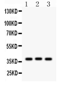 Invitrogen CTGF Polyclonal Antibody 100 &mu;g; Unconjugated:Antibodies,