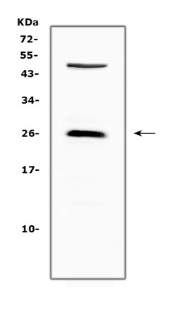 Invitrogen CTLA-4 (CD152) Polyclonal Antibody 100 μg; Unconjugated:Antibodies,