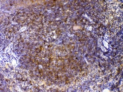 Invitrogen CTLA-4 (CD152) Polyclonal Antibody 100 μg; Unconjugated:Antibodies,