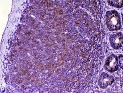 Invitrogen CTLA-4 (CD152) Polyclonal Antibody 100 μg; Unconjugated:Antibodies,
