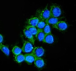 Invitrogen Cathepsin D Polyclonal Antibody 100 &mu;g; Unconjugated:Antibodies,