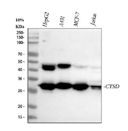Invitrogen Cathepsin D Polyclonal Antibody 100 &mu;g; Unconjugated:Antibodies,