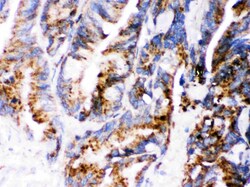 Invitrogen Cathepsin D Polyclonal Antibody 100 &mu;g; Unconjugated:Antibodies,