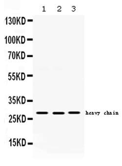 Invitrogen Cathepsin D Polyclonal Antibody 100 &mu;g; Unconjugated:Antibodies,