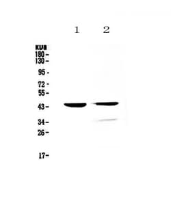 Invitrogen Cathepsin D Polyclonal Antibody 100 &mu;g | Buy Online | Invitrogen&trade; | Fisher Scientific