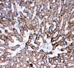 Invitrogen Cathepsin D Polyclonal Antibody 100 &mu;g; Unconjugated:Antibodies,