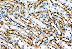 Invitrogen Cathepsin D Polyclonal Antibody 100 &mu;g; Unconjugated:Antibodies,