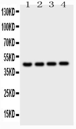 Invitrogen Cathepsin D Polyclonal Antibody 100 &mu;g; Unconjugated:Antibodies,