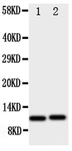 Invitrogen CXCL1 (GRO alpha) Polyclonal Antibody 100 &mu;g; Unconjugated:Antibodies,