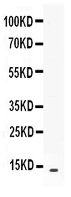 Invitrogen CXCL13 Polyclonal Antibody 100 &mu;g; Unconjugated:Antibodies,