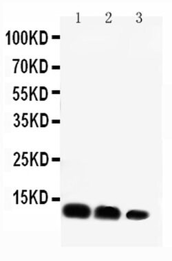 CXCL16 Rabbit anti-Mouse, Polyclonal, Invitrogen 100 &mu;g; Unconjugated:Anticuerpos