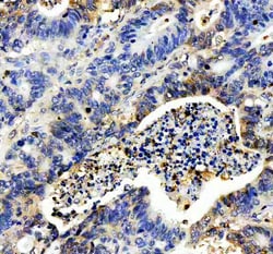 Invitrogen IL-8 (CXCL8) Polyclonal Antibody 100 &mu;g; Unconjugated:Antibodies,