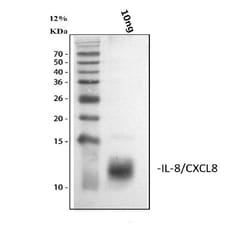 Invitrogen IL-8 (CXCL8) Polyclonal Antibody 100 &mu;g; Unconjugated:Antibodies,