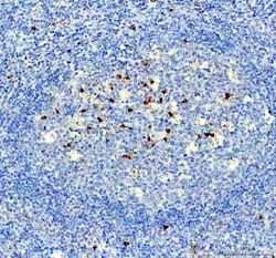 Invitrogen&trade;&nbsp;NOX2 Polyclonal Antibody