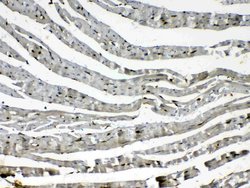Invitrogen Cytoglobin Polyclonal Antibody 100 &mu;g; Unconjugated:Antibodies,